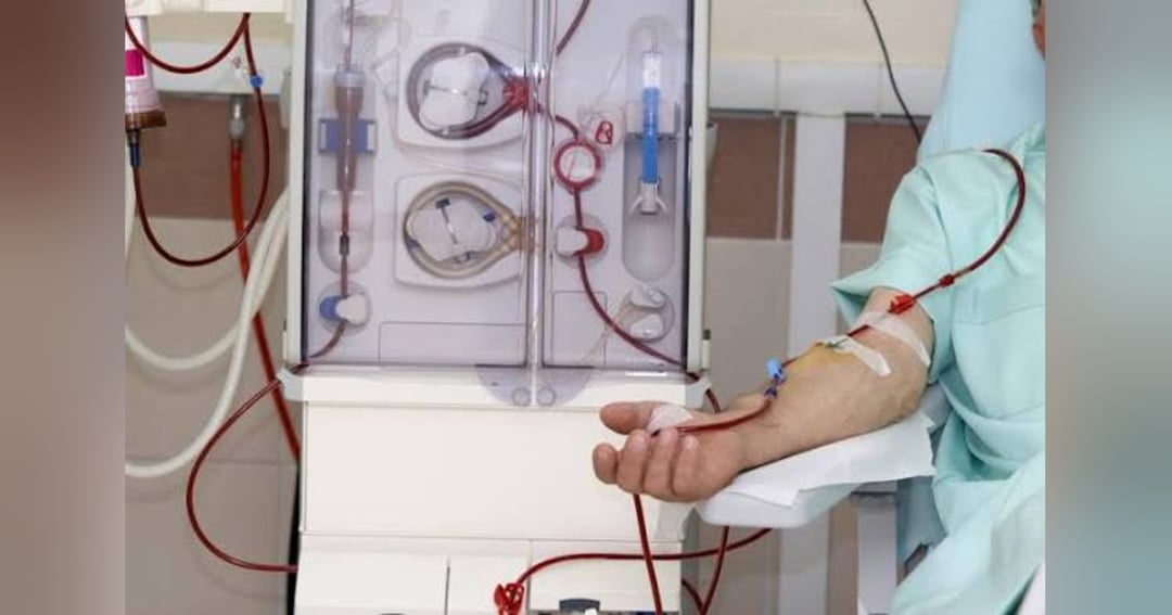 Dialysis technology, image 4